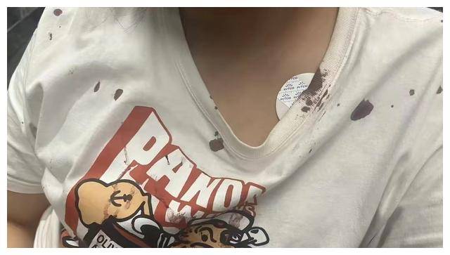 皇冠信用网押金多少_“杭州讨饭的狗”事件深思:刺痛多少打工人皇冠信用网押金多少,心疼的不是100押金