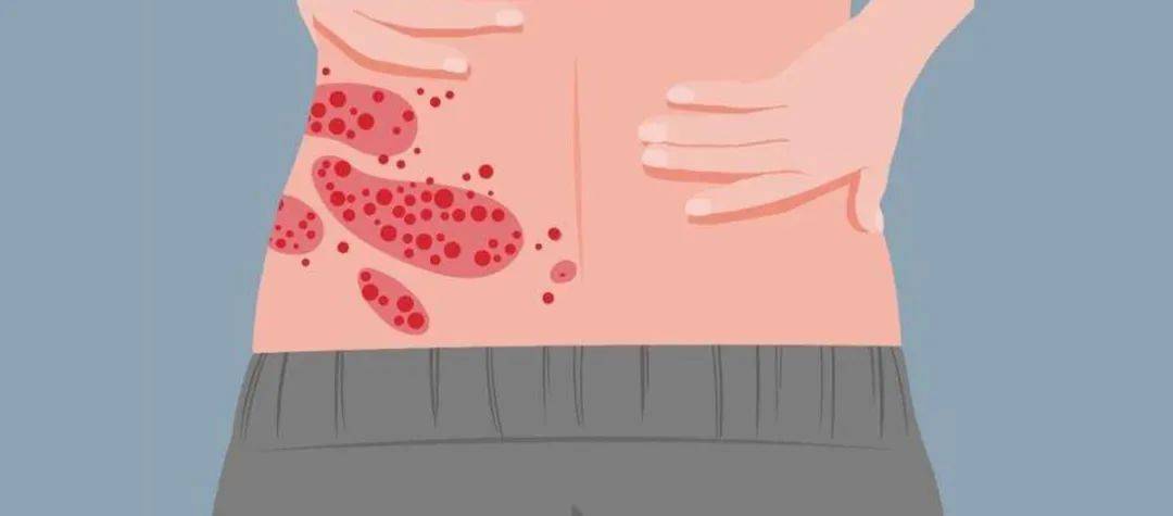 皇冠信用网登2代理_一旦感染终身携带皇冠信用网登2代理!深圳疾控提醒:这4类人要注意