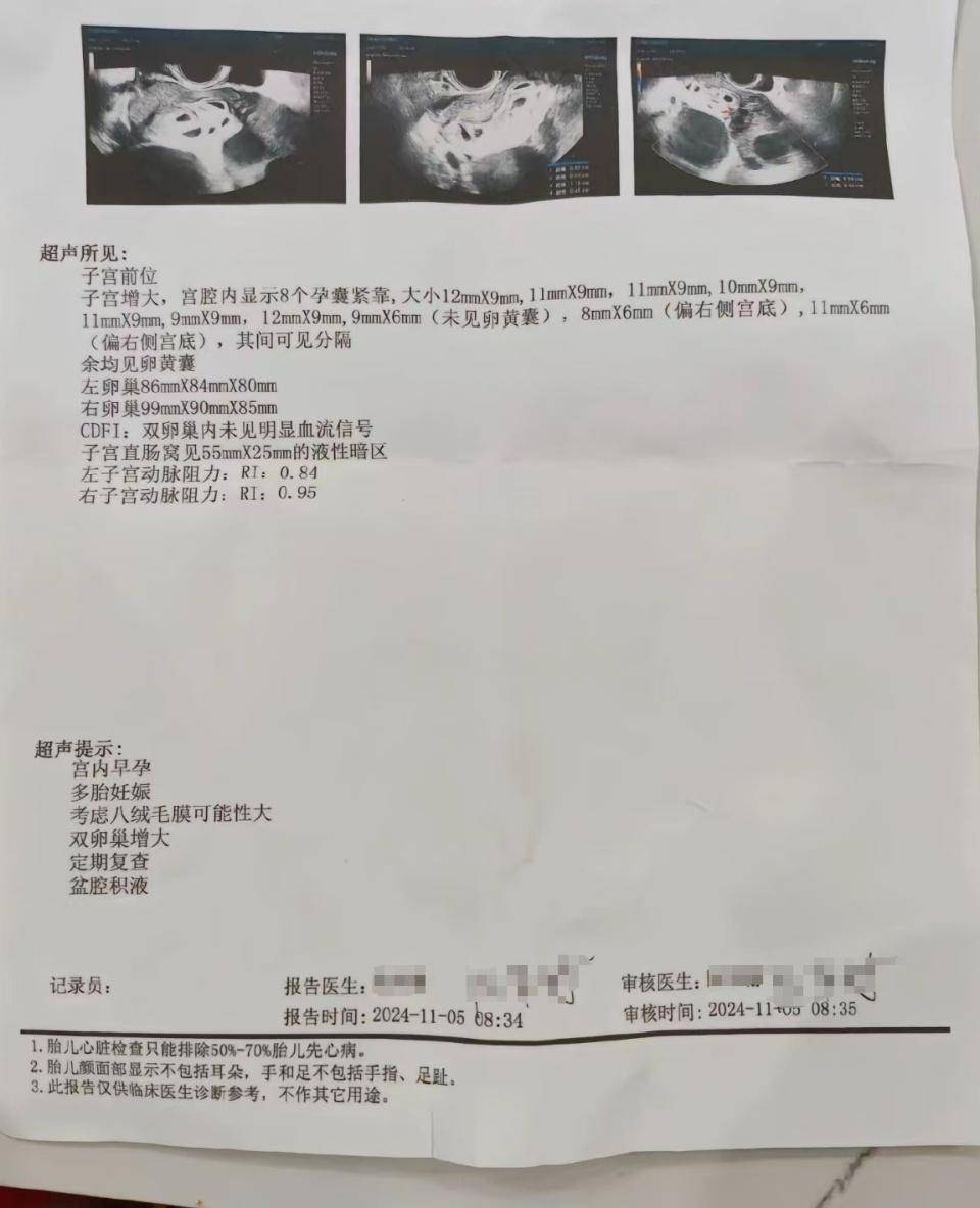 皇冠登一登二登三区别_怀上9胞胎女子今日进行减胎手术:分两次进行皇冠登一登二登三区别,第一次减去四个胚胎,第二次减去三个