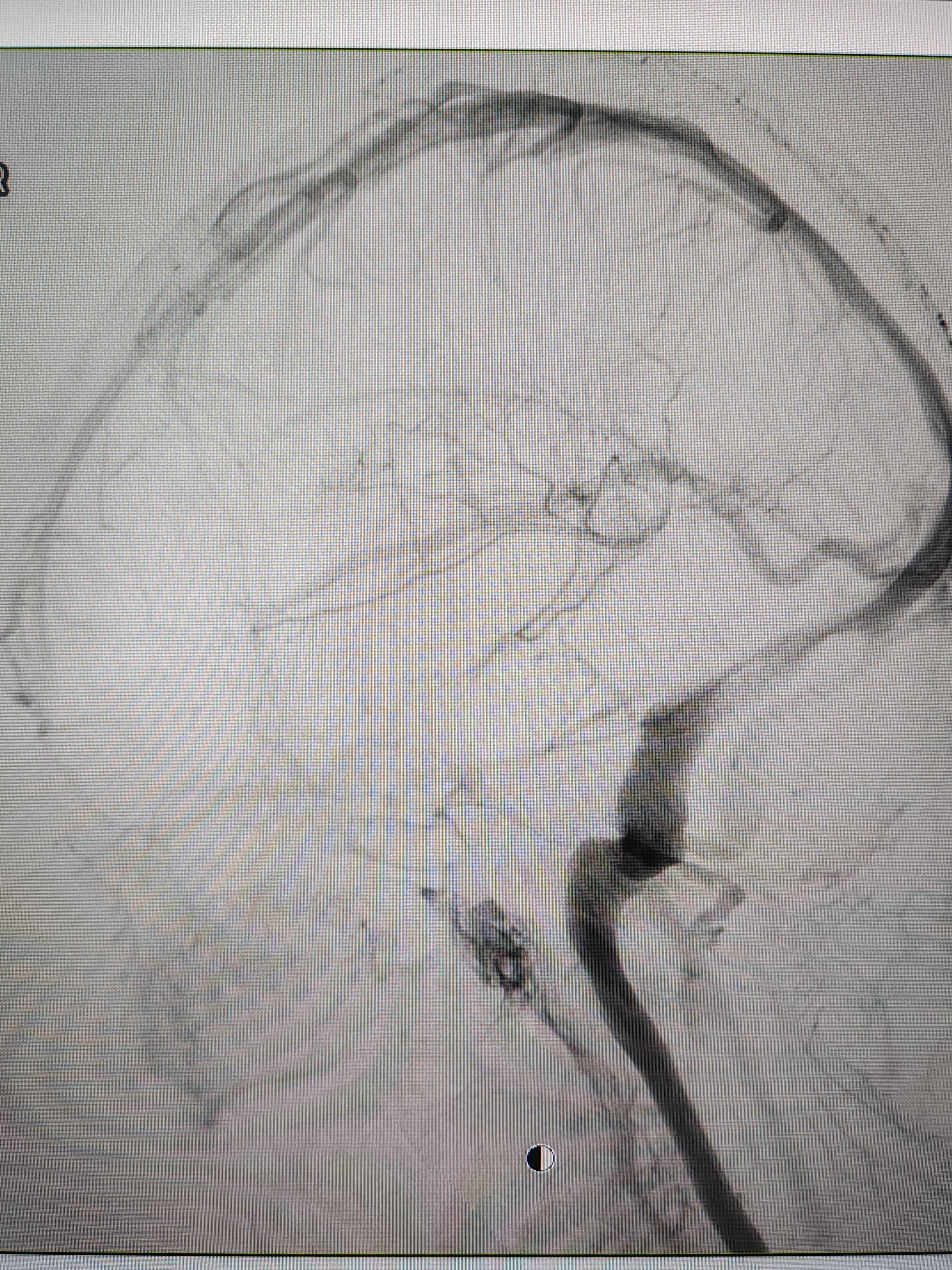 皇冠信用網出租足球_吉林女子患罕见耳鸣7年皇冠信用網出租足球,慕名千里来顺德寻医终获新生