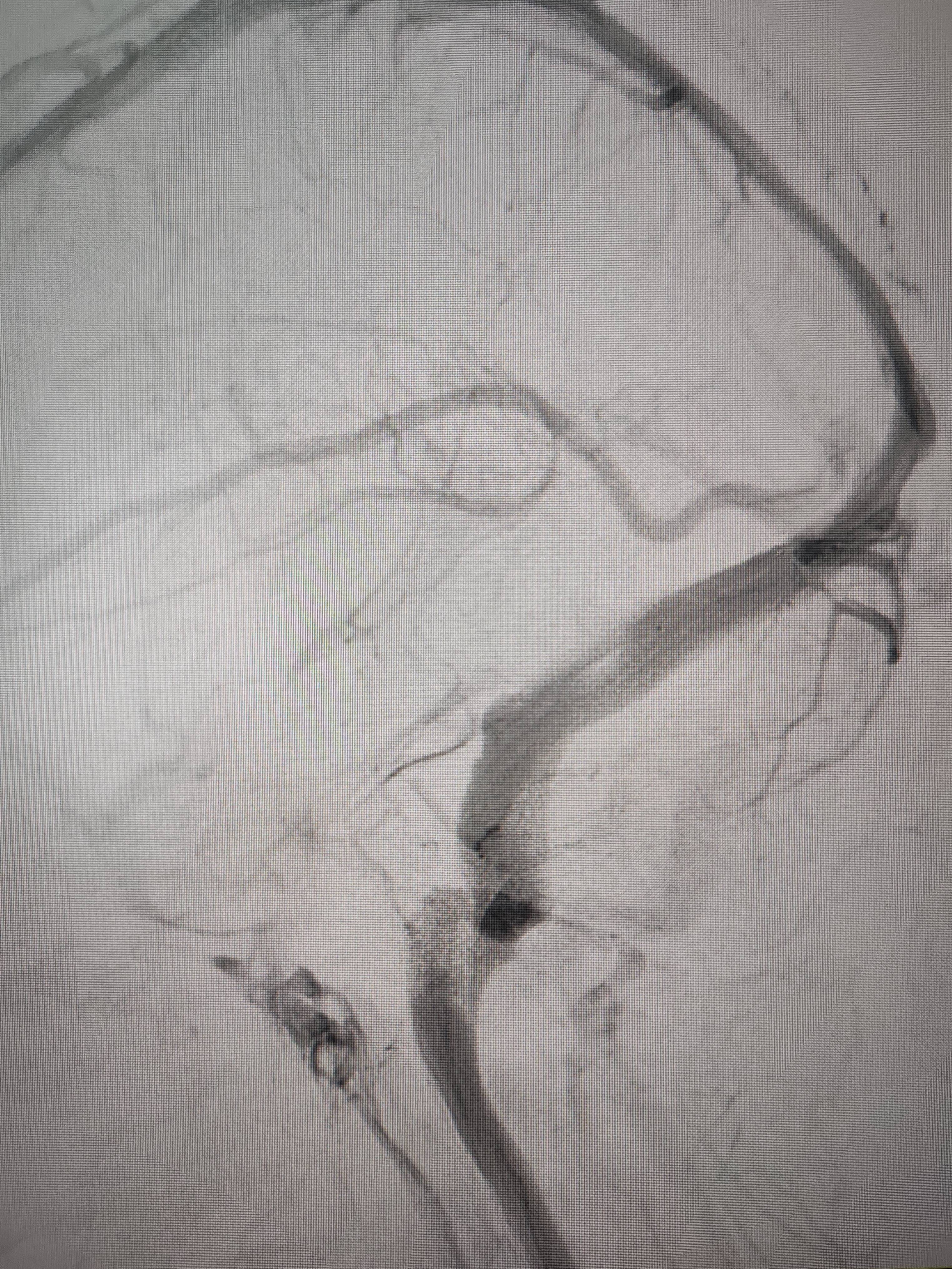 皇冠信用網出租足球_吉林女子患罕见耳鸣7年皇冠信用網出租足球,慕名千里来顺德寻医终获新生