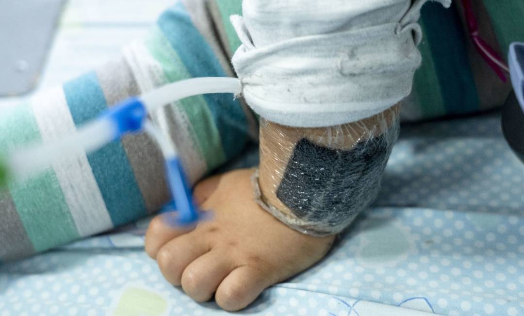 皇冠信用網账号注册
_可瞬间产生近100℃高温皇冠信用網账号注册
!合肥医生发出提醒