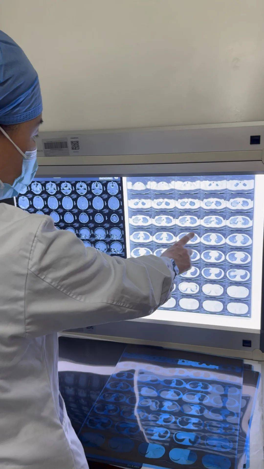 皇冠信用网开户
_河南一大学生咳嗽发烧近一月皇冠信用网开户
,多家诊所误当感冒治,医生:肺已全白