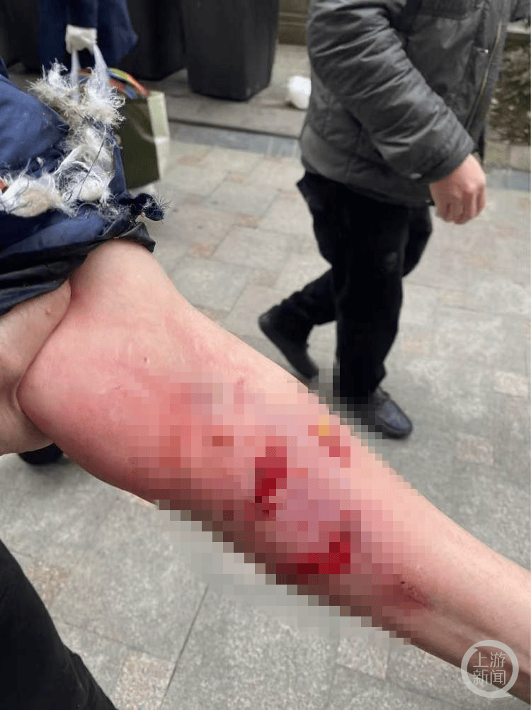 介绍个正网信用网址
_成都一女子小区电梯内被狗咬伤介绍个正网信用网址
,警方称肇事犬只已被控制