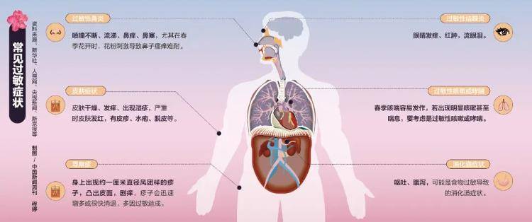 皇冠皇冠足球平台
_超2亿人过敏皇冠皇冠足球平台
,救命的方法都在这里了!
