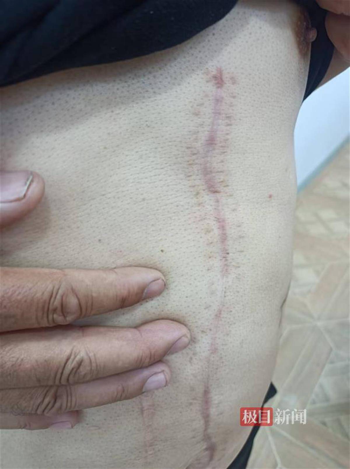 反恐精英2: PGL GLOBAL TOURNAMENT(3场2胜)_病房悲剧之谜：男子住院当晚捅伤同病房父子并跳楼身亡反恐精英2: PGL GLOBAL TOURNAMENT(3场2胜)，医院称其入院时无精神异常表现