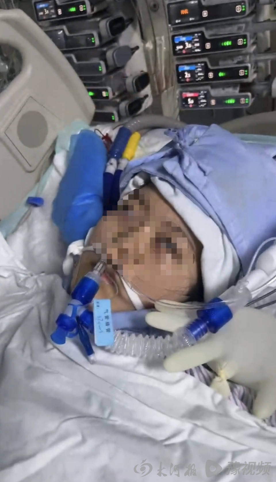 如何代理皇冠信用网_22岁美甲师手术成功却在复苏室脑死亡如何代理皇冠信用网，家属称缺氧30分钟监护医生未察觉，医院回应