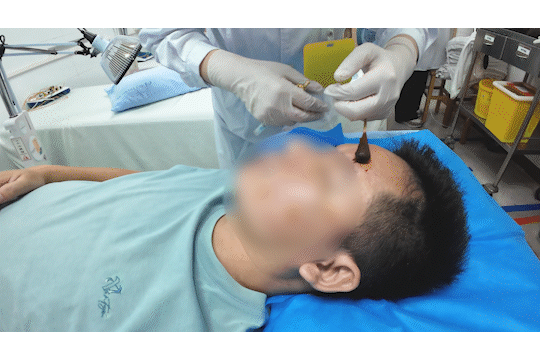 皇冠信用网登2代理
_醒来“天塌了”皇冠信用网登2代理
!深圳一女子眼睛闭不上、嘴巴漏水!这些错误很多人会犯