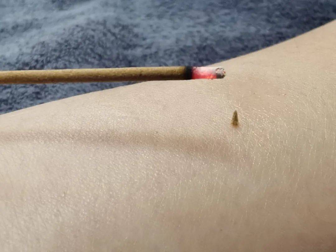 皇冠信用网登2代理
_醒来“天塌了”皇冠信用网登2代理
!深圳一女子眼睛闭不上、嘴巴漏水!这些错误很多人会犯