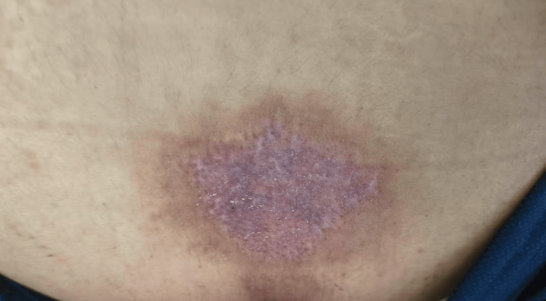 皇冠角球_14岁女孩在拓展营遭体罚去世皇冠角球,班主任因截留其给父母信件受审