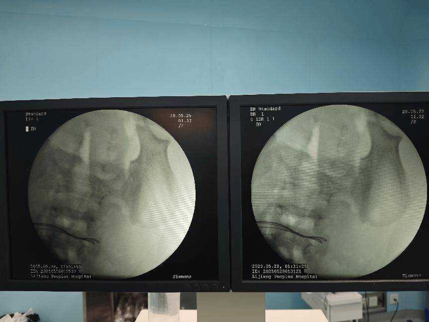 拜仁慕尼黑足球
_整整37颗拜仁慕尼黑足球
!云南4岁孩子身体里取出……医生紧急提醒!