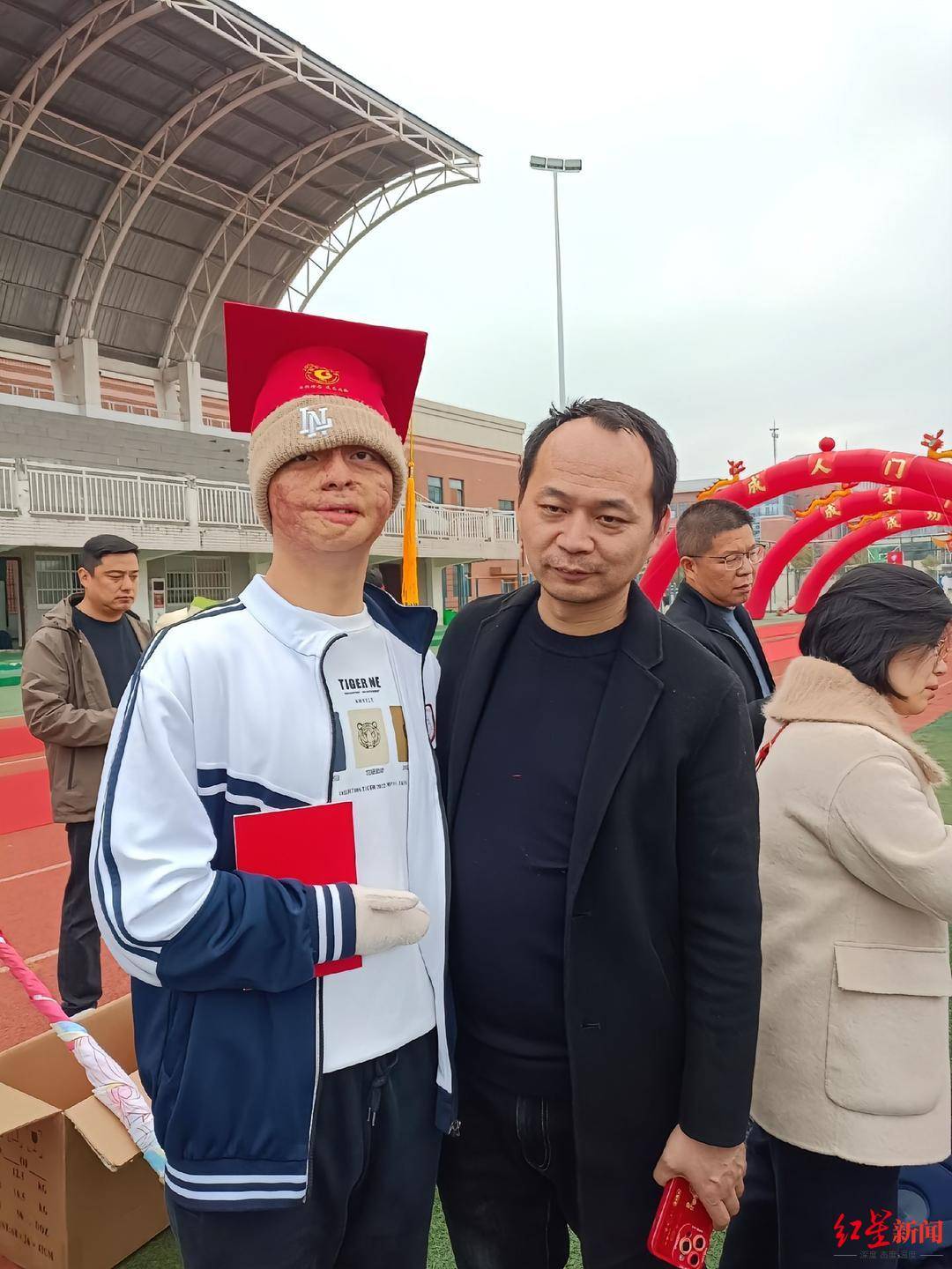 皇冠球網怎么做代理_“烧伤男孩”高考664分被东南大学录取:曾经历23次手术皇冠球網怎么做代理,计划未来读研读博