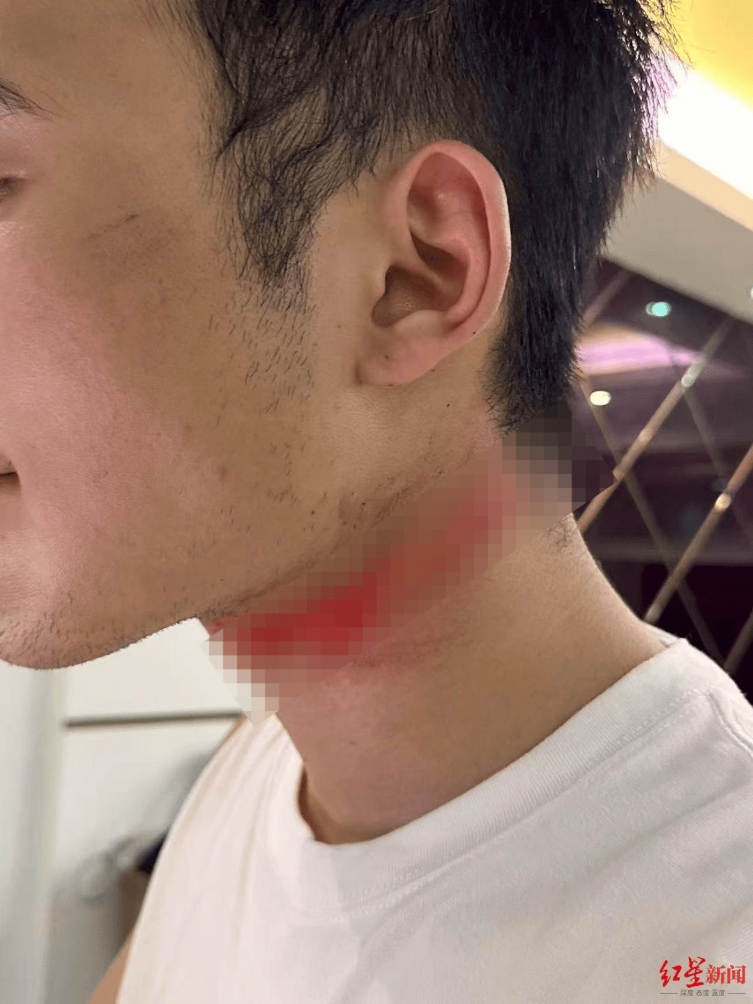 皇冠信用網APP下载
_男主播骑车载女友回家被路边掉落网线勒伤脖子皇冠信用網APP下载
,索赔3万陷僵局 律师解读该谁赔