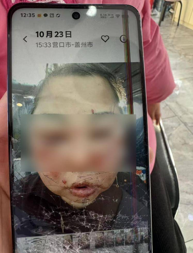 皇冠信用網出租_被前夫打进ICU的女子不幸身亡皇冠信用網出租,大女儿称正送母亲去殡仪馆,今后安排暂未考虑,希望严惩凶手