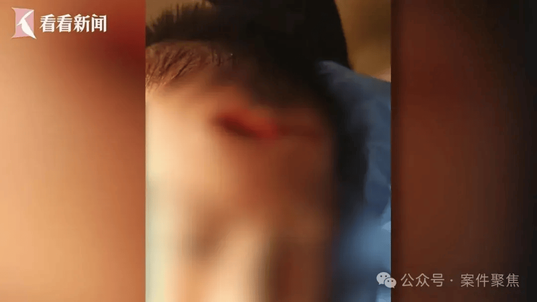 皇冠信用盘网址_血流不止皇冠信用盘网址,脸上缝30多针需整容!上海一知名火锅店发生意外,顾客和商家互相指责……