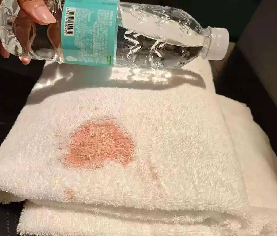 皇冠信用網如何申请_希岸酒店浴巾上出现大片血迹皇冠信用網如何申请,到底是谁的责任?