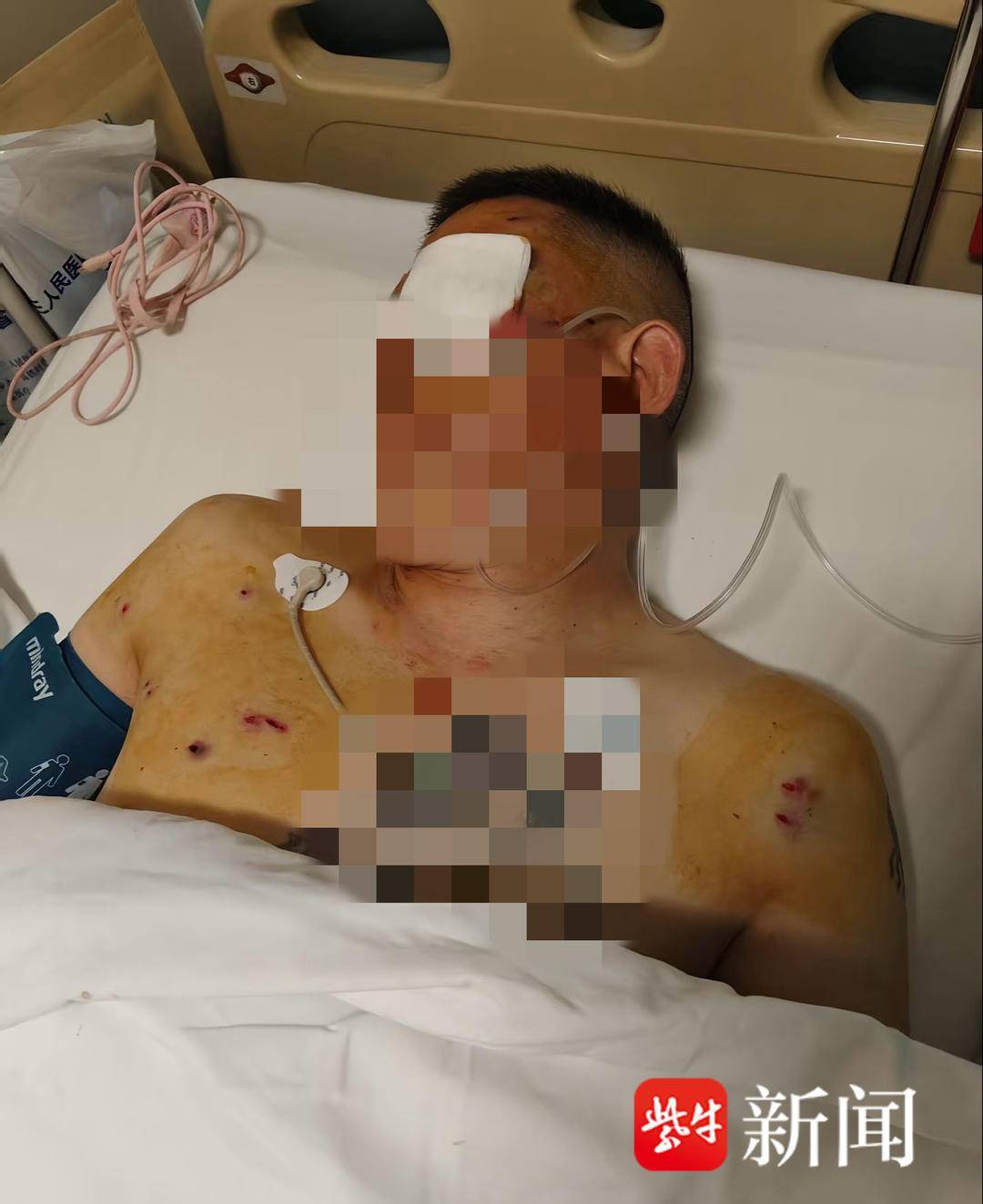 皇冠信用網代理
_紫牛头条|男子取款170万在银行门口遭抢劫致重伤皇冠信用網代理
,当事人认为银行保安未帮忙应担责