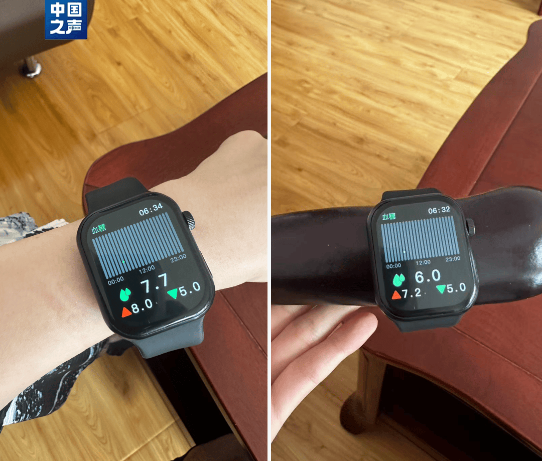 阿森纳vs利兹联
_父母花84元网购“神奇手表”阿森纳vs利兹联
,儿子发现能测万物:猫咪血糖5.9,吸尘器血糖7.4,父母:下次不买了